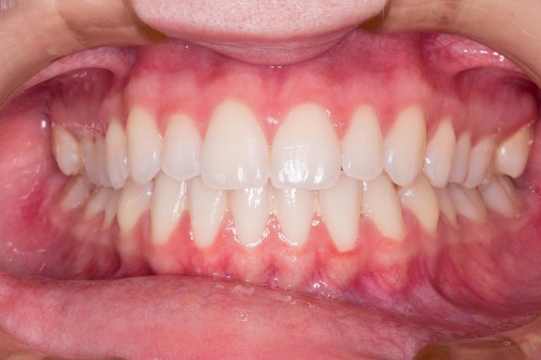Znakomite i bardzo dobre metody leczenia zębów